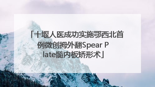 十堰人医成功实施鄂西北首例微创拇外翻Spear Plate髓内板矫形术